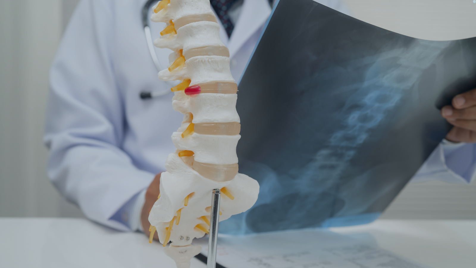 Imagem de destaque do artigo sobre osteoporose, osteopenia e saúde óssea